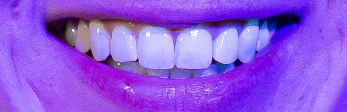 Smiling mouth with teeth under UV light