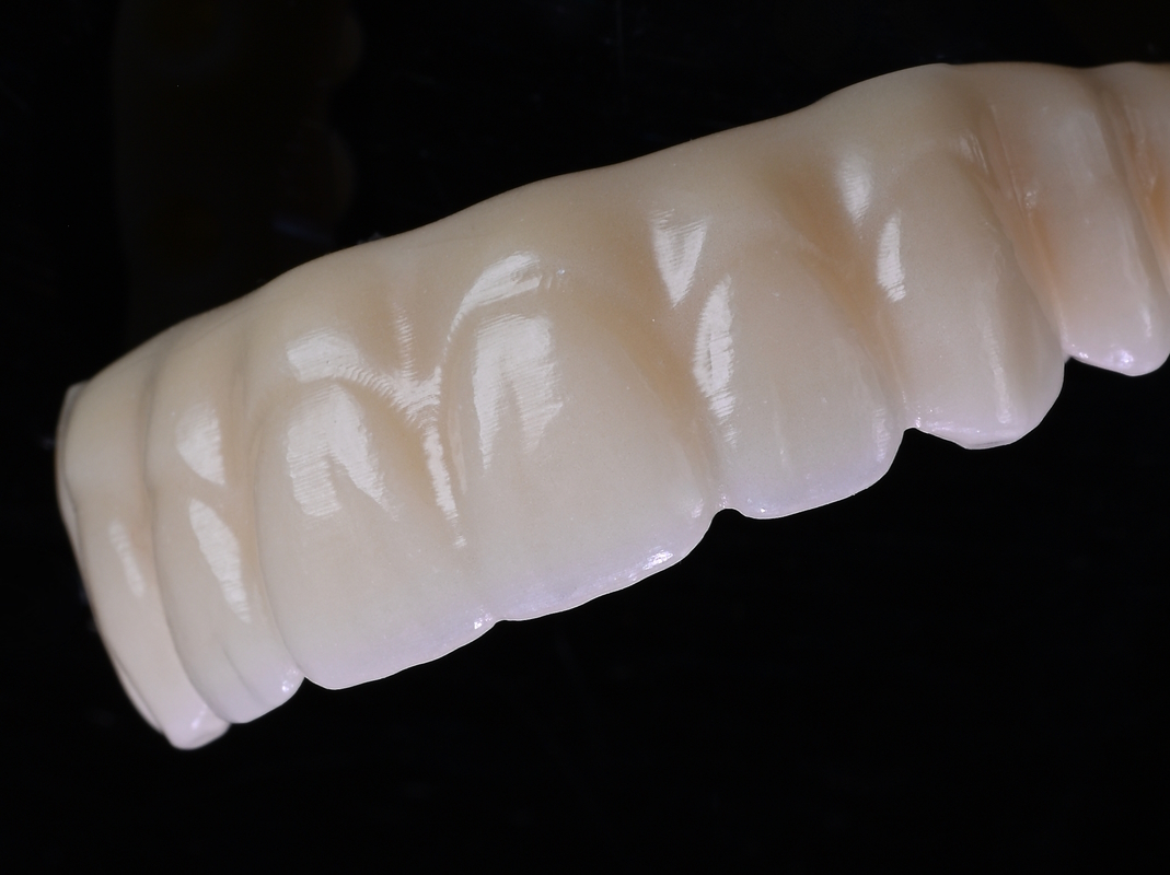 [Translate to English:] CORiTEC PMMA Brücke