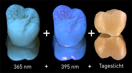 Zahn im Vergleich: Fluoreszenz bei 365nm und 395nm UV-Licht sowie Ansicht bei Tageslicht