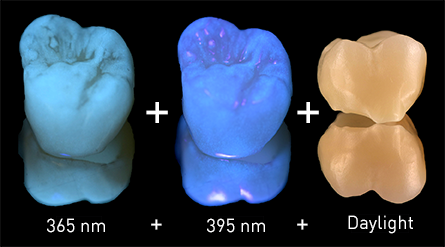 Tooth compared under 365nm UV light, 395nm UV light, and daylight