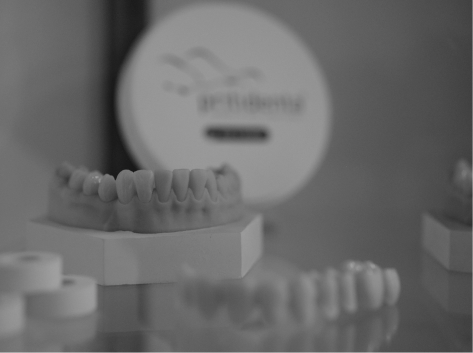 Modell mit dentalen Zahnkronen auf einer Ausstellungsfläche.